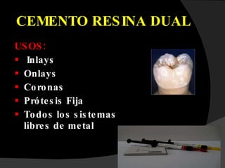 CEMENTO RESINA DUAL USOS: Inlays Onlays Coronas Prótesis Fija Todos los sistemas libres de metal 