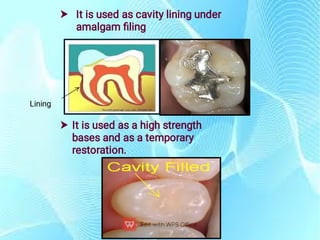 DENTAL CEMENTS Dental Material by Dr. pdf | PDF