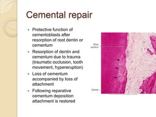 Cementum | PPTX