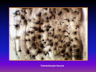 Cementocyte lacuna
 