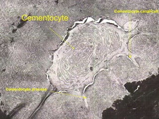 Cementocyte canaliculi
       Cementocyte




Cementocyte process
 