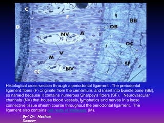 Histological cross-section through a periodontal ligament . The periodontal
ligament fibers (F) originate from the cementum. and insert into bundle bone (BB),
so named because it contains numerous Sharpey's fibers (SF). Neurovascular
channels (NV) that house blood vessels, lymphatics and nerves in a loose
connective tissue sheath course throughout the periodontal ligament. The
ligament also contains cell rests of Malassez (M).
         By/ Dr. Hesham
         Dameer
 