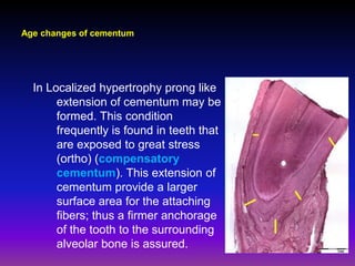 Age changes of cementum




  In Localized hypertrophy prong like
       extension of cementum may be
       formed. This condition
       frequently is found in teeth that
       are exposed to great stress
       (ortho) (compensatory
       cementum). This extension of
       cementum provide a larger
       surface area for the attaching
       fibers; thus a firmer anchorage
       of the tooth to the surrounding
       alveolar bone is assured.
 