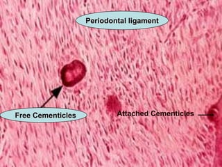 Periodontal ligament




Free Cementicles           Attached Cementicles
 