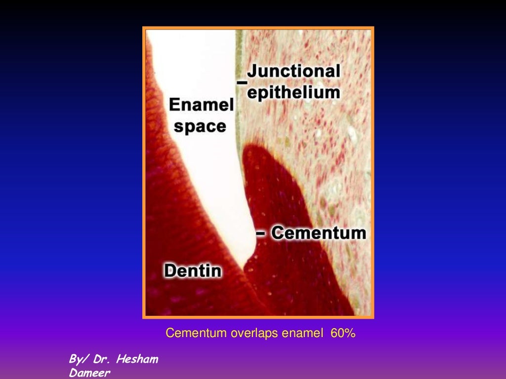 Cementum