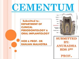 CEMENTUM
Submitted to:DEPARTMENT OF
CLINICAL
PERIODONTOLOGY &
ORAL IMPLANTOLOGY
HOD & PROF.- DR.
RANJAN MALHOTRA

 