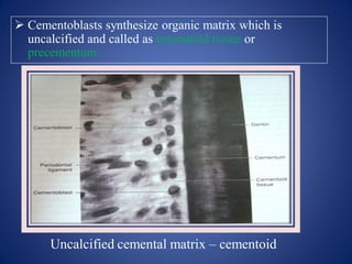  Cementoblasts synthesize organic matrix which is
uncalcified and called as cementoid tissue or
precementum
Uncalcified cemental matrix – cementoid
 