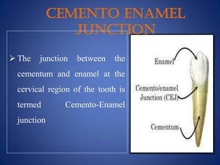 CEMENTO ENAMEL
JUNCTION
 The junction between the
cementum and enamel at the
cervical region of the tooth is
termed Cemento-Enamel
junction
 