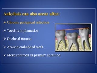 Ankylosis can also occur after:
 Chronic periapical infection
 Tooth reimplantation
 Occlusal trauma
 Around embedded teeth.
 More common in primary dentition
 