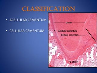 CLASSIFICATION
• ACELLULAR CEMENTUM
• CELLULAR CEMENTUM
 