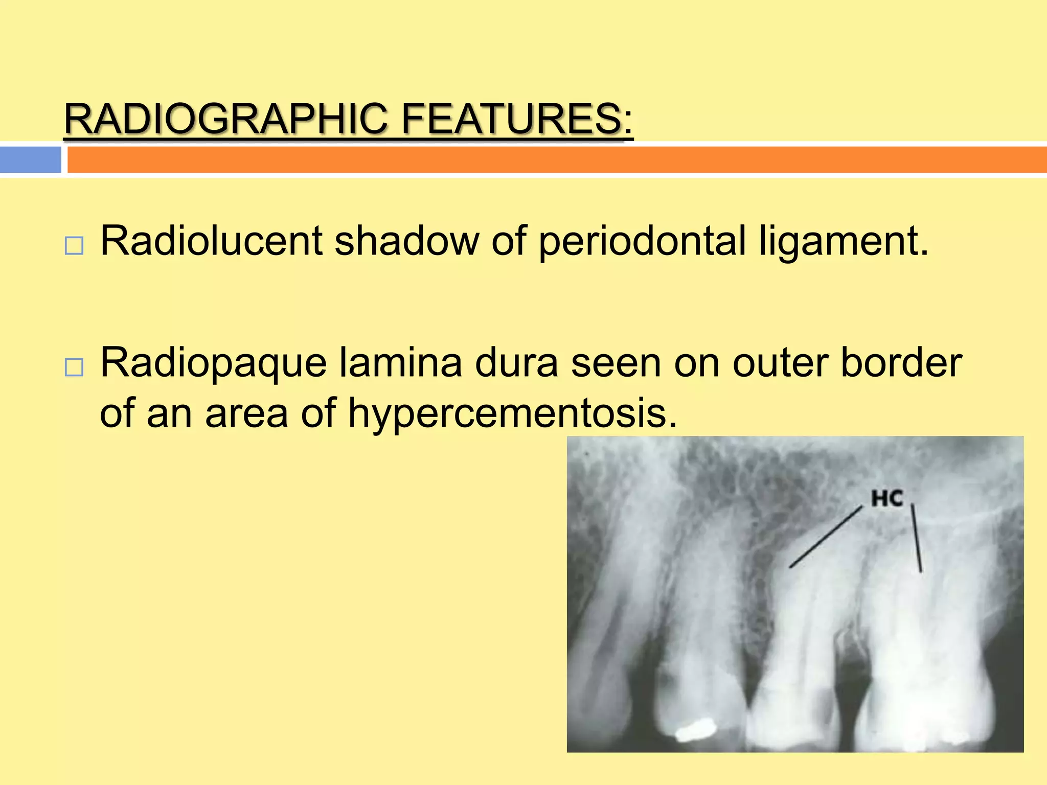 Cementum | PPTX