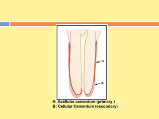 A: Acellular cementum (primary )
B: Cellular Cementum (secondary)
 