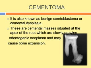 CEMENTOMA
 It is also known as benign cemtoblastoma or
cemental dysplasia.
 These are cemental masses situated at the
apex of the root which are slowly growing
odontogenic neoplasm and may
cause bone expansion.
 