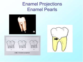 Cementum-20207231215390.ppt