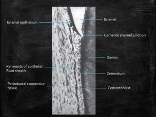 cementum.pptx