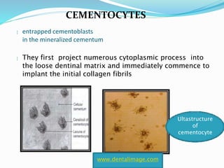  entrapped cementoblasts
in the mineralized cementum
 They first project numerous cytoplasmic process into
the loose dentinal matrix and immediately commence to
implant the initial collagen fibrils
www.dentalimage.com
Ultastructure
of
cementocyte
CEMENTOCYTES
 