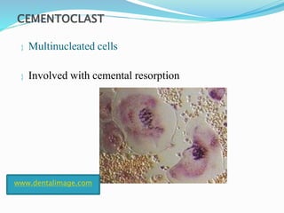  Multinucleated cells
 Involved with cemental resorption
www.dentalimage.com
 