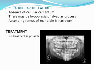RADIOGRAPHIC FEATURES
• Absence of cellular cementum
• There may be hypoplasia of alveolar process
• Ascending ramus of mandible is narrower
TREATMENT
 No treatment is possible
 