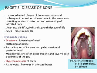  uncoordinated phases of bone resorption and
subsequent deposition of new bone in the same area
resulting in severe distortion and weakening of
affected bone
 Age- usually fifth,sixth and seventh decade of life
 Sites – more in maxilla
Oral manifestations
- Diastema , loosening of teeth
- Flattening of palate
- Retroclination of incisors and palatoversion of
posterior teeth
- Maxillary lesions often cross midline and involve both
quadrants of the jaw
- Hypercementosis of teeth
- Pathological fractures in affected bones
9.Shafer’s textbook
of oral pathology,
6th edition
 