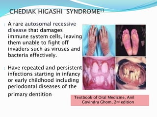  A rare autosomal recessive
disease that damages
immune system cells, leaving
them unable to fight off
invaders such as viruses and
bacteria effectively.
 Have repeated and persistent
infections starting in infancy
or early childhood including
periodontal diseases of the
primary dentition
Textbook of Oral Medicine, Anil
Govindra Ghom, 2nd edition
 