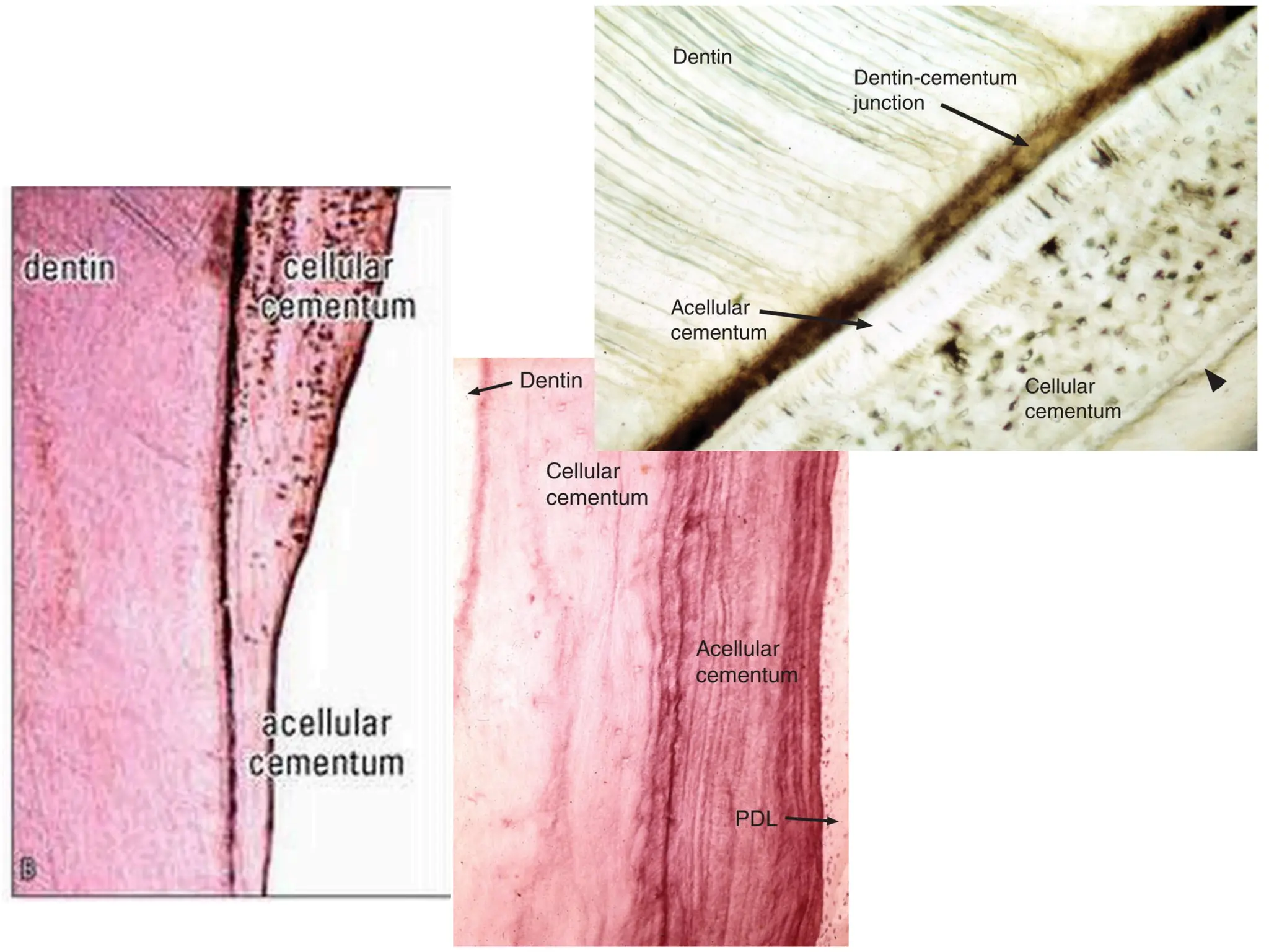 Cementum Histology Diagram