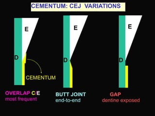 Cementum study in periodontics and perio.ppt