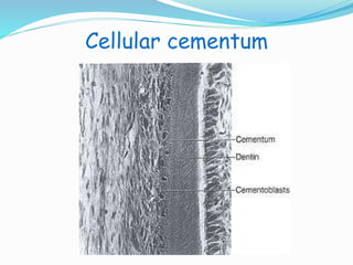 Cellular cementum 
 