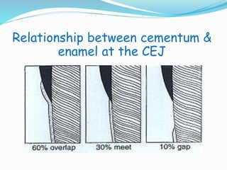 Relationship between cementum & 
enamel at the CEJ 
 