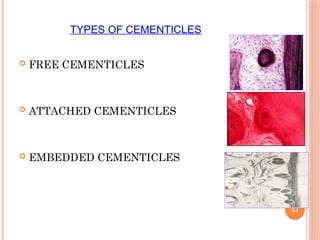 CEMENTUM-a dynamically active tissue in peridontium | PPTX