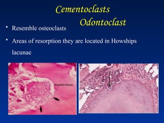 Cementoclasts
Odontoclast
• Resemble osteoclasts
• Areas of resorption they are located in Howships
lacunae
 