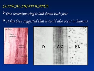 CLINICAL SIGNIFICANCE
One cementum ring is laid down each year
It has been suggested that it could also occur in humans
 