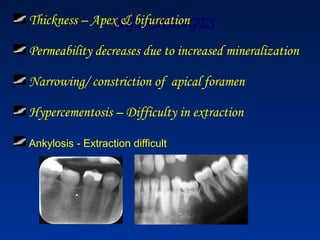 AGE CHANGES
Thickness – Apex & bifurcation
Permeability decreases due to increased mineralization
Narrowing/ constriction of apical foramen
Hypercementosis – Difficulty in extraction
Ankylosis - Extraction difficult
 