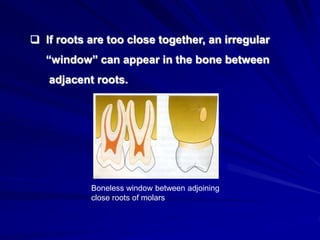 TOOTH ROOT CEMENTUM- A HISTOLOGICAL STUDY | PPT