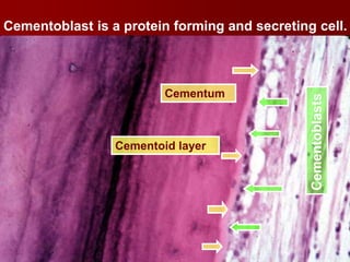 Cementum 2014 | PPTX