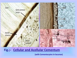 Fig.;- Cellular and Acellular Cementum
(with Cementocytes in lacunae)
 
