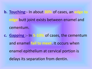 b. Touching:- In about 30% of cases, an edge to
edge butt joint exists between enamel and
cementum.
c. Gapping :- In 5-10% of cases, the cementum
and enamel fail to meet. It occurs when
enamel epithelium at cervical portion is
delays its separation from dentin.
 