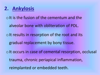 2. Ankylosis
oIt is the fusion of the cementum and the
alveolar bone with obliteration of PDL.
oIt results in resorption of the root and its
gradual replacement by bony tissue.
oIt occurs in case of cemental resorption, occlusal
trauma, chronic periapical inflammation,
reimplanted or embedded teeth.
 