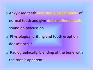 .
o Ankylosed teeth lack physiologic mobility of
normal teeth and give dull, muffled metallic
sound on percussion.
o Physiological drifting and tooth eruption
doesn’t occur.
o Radiographically, blending of the bone with
the root is apparent.
 