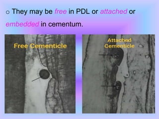 o They may be free in PDL or attached or
embedded in cementum.
 