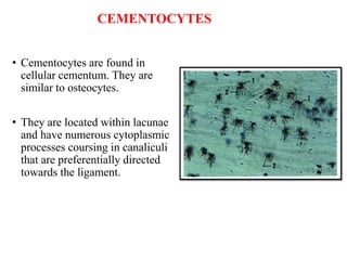 cementum by dr. ishu singla.pptx