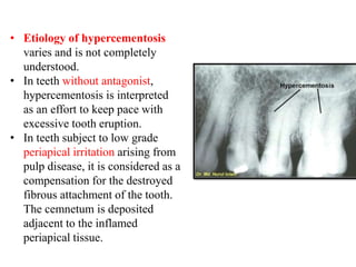 cementum by dr. ishu singla.pptx