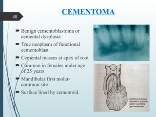 Comprehensive Overview of Cementum: Structure, Types, and Clinical ...