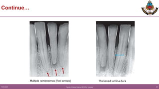 Cementum_Dhanraj_meena-17 09 23 (1).pptx