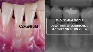 CEMENTUM
By: Dr. SOMRAJ PODDER
1ST YEAR POST GRADUATE
STUDENT
DEPARTMENT OF CONSERVATIVE
DENTISTRY AND ENDODONTICS
CEMENTUM
BY: Dr. SOMRAJ PODDER
1ST YEAR POST GRADUATE STUDENT
DEPARTMENT OF CONSERVATIVE
DENTISTRY AND ENDODONTICS
 