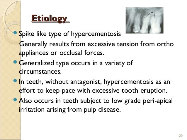 hypercementosis