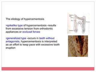 Cementum | PPTX