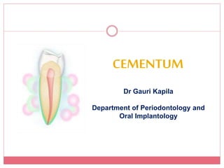 CEMENTUM
Dr Gauri Kapila
Department of Periodontology and
Oral Implantology
 