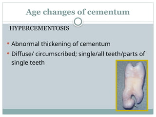 CEMENTUM AND CEMENTOGENESIS LECTURE.pptx