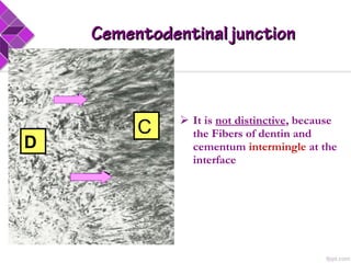  It is not distinctive, because
the Fibers of dentin and
cementum intermingle at the
interface
C
D
Cementodentinal junctionCementodentinal junction
 