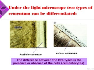 Under the light microscope two types of
cementum can be differentiated:
Acellular cementum
cellular cementum
The difference between the two types is the
presence or absence of the cells (cementocytes)
 